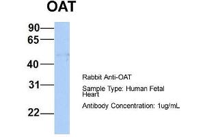 Host:  Rabbit  Target Name:  OAT  Sample Type:  Human Fetal Heart  Antibody Dilution:  1. (OAT 抗体  (Middle Region))