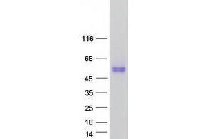 Validation with Western Blot (TMEM30A Protein (Transcript Variant 1) (Myc-DYKDDDDK Tag))