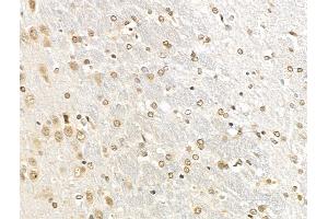 ABIN7094789 and ABIN7098840 at 1/100 staining Rat brain tissue by IHC-P. (IRF8 抗体  (Internal Region))