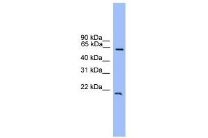 WB Suggested Anti-DACH1 Antibody Titration:  0.