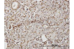 Immunoperoxidase of monoclonal antibody to HIPK1 on formalin-fixed paraffin-embedded human salivary gland. (HIPK1 抗体  (AA 330-430))