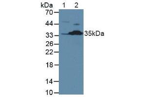 Western blot analysis of (1) Human Jurkat Cells and (2) Mouse Kidney Tissue. (Caspase 2 抗体  (AA 334-452))