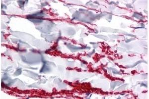 Human Skin, Dermis: Formalin-Fixed, Paraffin-Embedded (FFPE) (FAM59A 抗体  (C-Term))