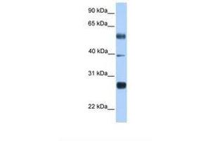Image no. 1 for anti-MAX Dimerization Protein 3 (MXD3) (N-Term) antibody (ABIN6737887) (MXD3 抗体  (N-Term))