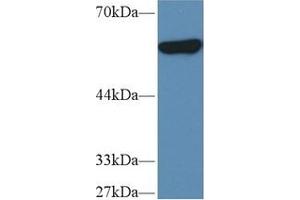Western Blotting (WB) image for anti-Pyruvate Kinase M2 (PKM2) (AA 141-248) antibody (ABIN7432133)