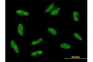 Immunofluorescence of purified MaxPab antibody to VGLL2 on HepG2 cell. (VGLL2 抗体  (AA 1-317))