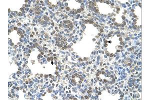 Immunohistochemistry (IHC) image for anti-Solute Carrier Family 26, Member 5 (Prestin) (SLC26A5) (Middle Region) antibody (ABIN310566) (SLC26A5 抗体  (Middle Region))