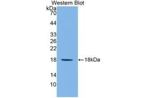 Detection of Recombinant IL1F9, Mouse using Monoclonal Antibody to Interleukin 1 Family, Member 9 (IL1F9) (IL1F9 抗体  (AA 5-149))