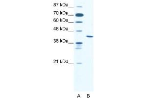 Human Jurkat; WB Suggested Anti-ZNF621 Antibody Titration: 2. (ZNF621 抗体  (Middle Region))