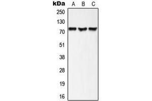 Western blot analysis of AKAP10 expression in HepG2 (A), mouse heart (B), rat heart (C) whole cell lysates.