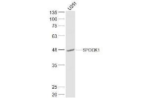 U251 lysates probed with SPOCK1 Polyclonal Antibody, Unconjugated  at 1:500 dilution and 4˚C overnight incubation. (SPOCK1 抗体  (AA 51-150))