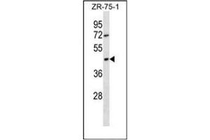 Western blot analysis of OR2T6 Antibody (C-term) in ZR-75-1 cell line lysates (35ug/lane). (OR2T6 抗体  (C-Term))