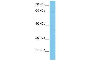 Western Blotting (WB) image for anti-Tyrosinase-Related Protein 1 (TYRP1) (Middle Region) antibody (ABIN2781815)