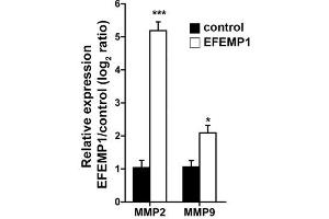 Fibulin 3 (FBLN3) (Transcript Variant 1) (Active) protein (Myc-DYKDDDDK Tag)