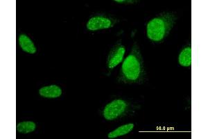 Immunofluorescence of monoclonal antibody to UBA6 on HeLa cell.