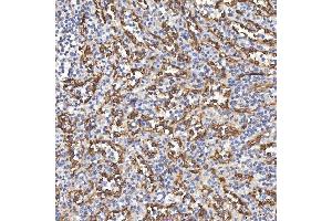 IHC analysis of TP53I13 using anti-TP53I13 antibody (ABIN7601220). (TP53I13 抗体  (AA 30-365))