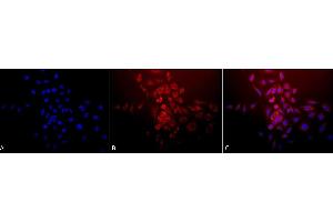 Immunocytochemistry/Immunofluorescence analysis using Rabbit Anti-SOD (Mn) Polyclonal Antibody (ABIN361655 and ABIN361656). (SOD2 抗体)
