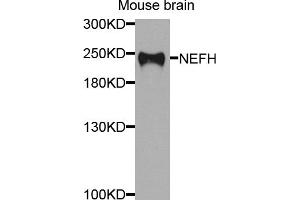 Western blot analysis of extracts of mouse brain, using NEFH antibody (ABIN5974903) at 1/1000 dilution. (NEFH 抗体)