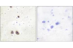 Immunohistochemistry analysis of paraffin-embedded human brain tissue, using Caper Antibody. (RBM39 抗体  (AA 171-220))