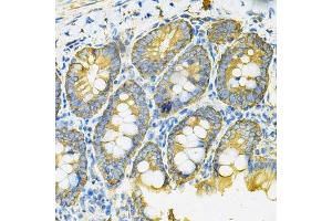 Immunohistochemistry of paraffin-embedded rat intestine using HSP90AB1 Antibody. (HSP90AB1 抗体  (AA 1-300))