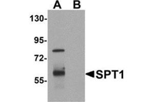 Western blot analysis of VASH1 in human brain tissue lysate with VASH1 antibody at 1 μg/ml in (A) the absence and (B) the presence of blocking peptide. (VASH1 抗体  (C-Term))