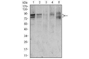 Image no. 4 for anti-Forkhead Box P1 (FOXP1) antibody (ABIN1491561) (FOXP1 抗体)