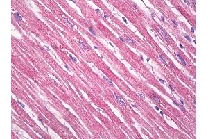 Anti-TPM3 antibody IHC of human heart. (TPM3 抗体  (AA 1-249))
