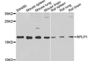 Western blot analysis of extracts of various cell lines, using RPLP1 antibody (ABIN2559767) at 1:1000 dilution. (RPLP1 抗体)