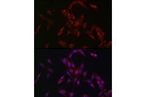 Immunofluorescence analysis of PC-12 cells using MR1 Rabbit pAb (ABIN6131925, ABIN6143983, ABIN6143984 and ABIN6224070) at dilution of 1:100 (40x lens). (MR1 抗体  (AA 20-260))