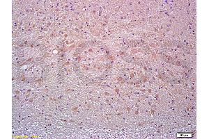 Formalin-fixed and paraffin embedded rat brain tissue labeled with Anti-Thy-1/CD90/ Thy1. (CD90 抗体  (AA 31-120))