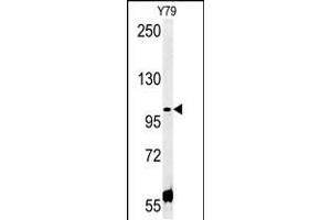 Western blot analysis in Y79 cell line lysates (35ug/lane). (CCDC146 抗体  (N-Term))