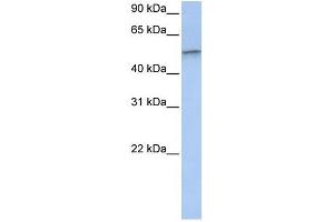 Vimentin antibody used at 1 ug/ml to detect target protein. (Vimentin 抗体  (C-Term))
