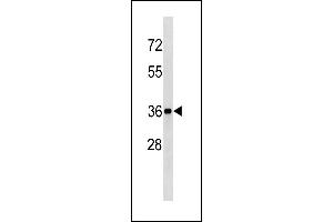 BLVRA Antibody (Center Y83) (ABIN1881115 and ABIN2843340) western blot analysis in mouse kidney tissue lysates (35 μg/lane). (Biliverdin Reductase 抗体  (AA 61-89))
