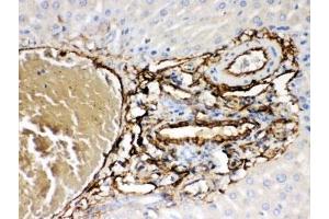IHC-P: ABCB4 antibody testing of rat liver tissue