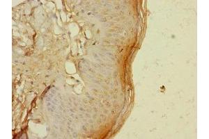 Immunohistochemistry of paraffin-embedded human skin tissue using ABIN7172192 at dilution of 1:100 (TIGD4 抗体  (AA 301-512))