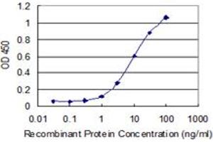 Detection limit for recombinant GST tagged NEB is 0. (Nebulin 抗体  (AA 2108-2217))