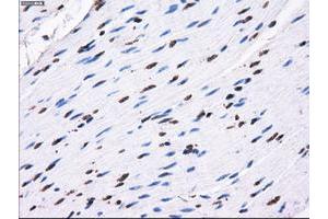 Image no. 1 for anti-Replication Protein A2, 32kDa (RPA2) antibody (ABIN1500736) (RPA2 抗体)