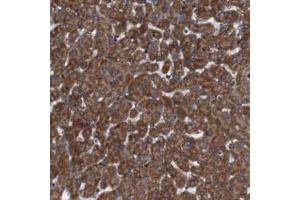 Immunohistochemical staining (Formalin-fixed paraffin-embedded sections) of human liver with SIGLEC8 polyclonal antibody  shows strong cytoplasmic positivity in hepatocytes at 1:50-1:200 dilution.