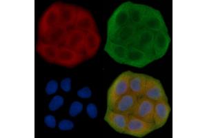 ABIN7095684 and ABIN7099746 staining Hela cells(30 min of UV treatment) by IF/ICC. (KLHL26 抗体)