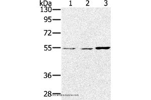 Western blot analysis of Lovo, hela and SKOV3 cell, using SESN2 Polyclonal Antibody at dilution of 1:300 (Sestrin 2 抗体)