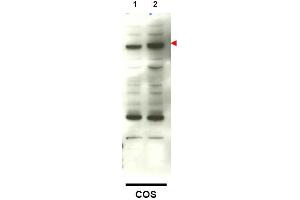 Image no. 1 for anti-SMAD Family Member 4 (SMAD4) (C-Term) antibody (ABIN401410) (SMAD4 抗体  (C-Term))