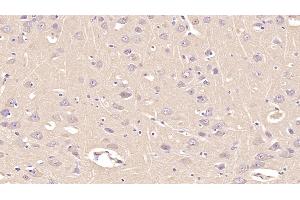 Detection of ANXA5 in Human Cerebrum Tissue using Monoclonal Antibody to Annexin V (ANXA5)
