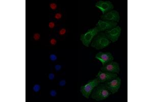 COMMD5 Antibody staining Hela cells by IF/ICC.