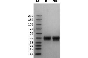 SDS-PAGE (SDS) image for Fc Fragment of IgG, Low Affinity IIb, Receptor (CD32) (FCGR2B) (AA 46-217) protein (His-Avi Tag,Biotin) (ABIN7536870)