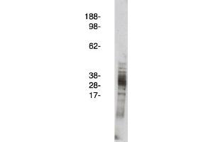 Image no. 1 for anti-Arachidonate 5-Lipoxygenase-Activating Protein (ALOX5AP) antibody (ABIN265257) (ALOX5AP 抗体)