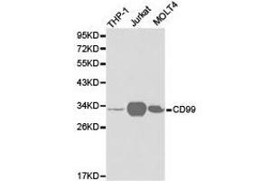 Western Blotting (WB) image for anti-CD99 (CD99) antibody (ABIN1871666) (CD99 抗体)
