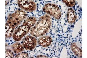 Image no. 2 for anti-Aminoacylase 3 (ACY3) antibody (ABIN1496465) (Aminoacylase 3 抗体)