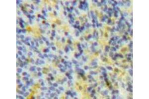 Used in DAB staining on fromalin fixed paraffin-embedded Spleen tissue (SOCS3 抗体  (AA 1-225))