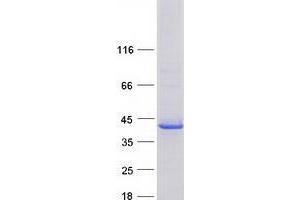 Western Blotting (WB) image for V-Set and Immunoglobulin Domain Containing 2 (VSIG2) protein (Myc-DYKDDDDK Tag) (ABIN2735444)