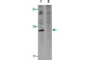 Western blot analysis of EL4 cells with TSPAN9 polyclonal antibody  at 1 ug/mL in (Lane 1) the absence and (Lane 2) the presence of blocking peptide. (Tetraspanin 9 抗体)